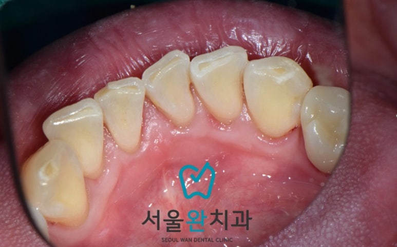 서울완치과 이미지