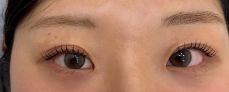 미미체형관리 이미지