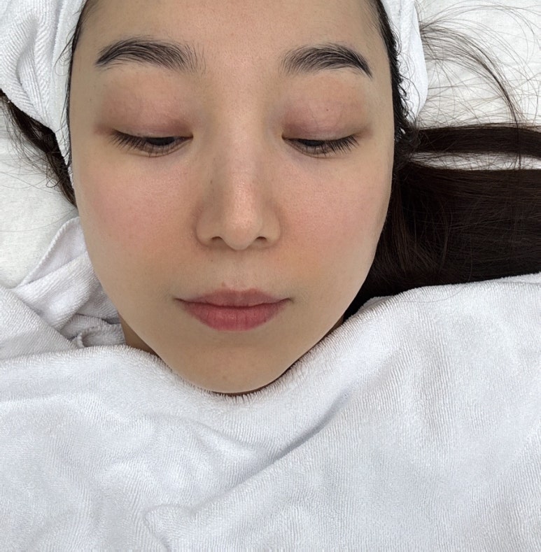 제이비비 이미지