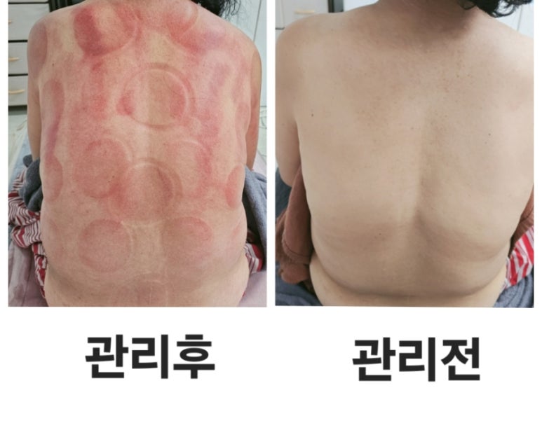 오늘은밝은피부 이미지