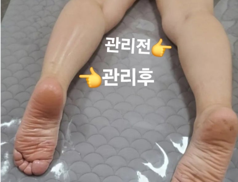 오늘은밝은피부 이미지