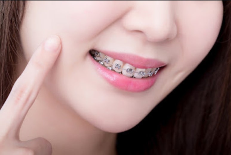 아삭플란트치과의원 이미지