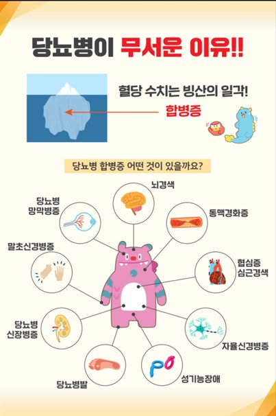 에스케어 이미지