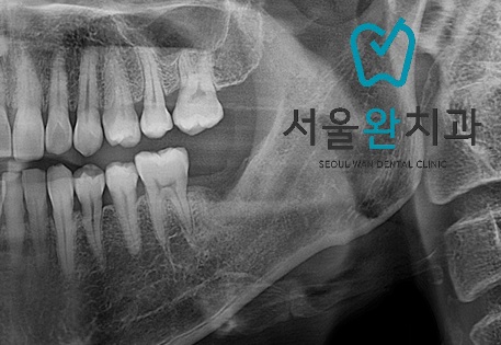 서울완치과 이미지