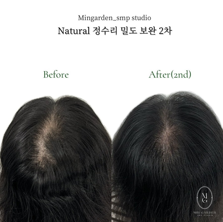 헤어팡팡&가발 이미지