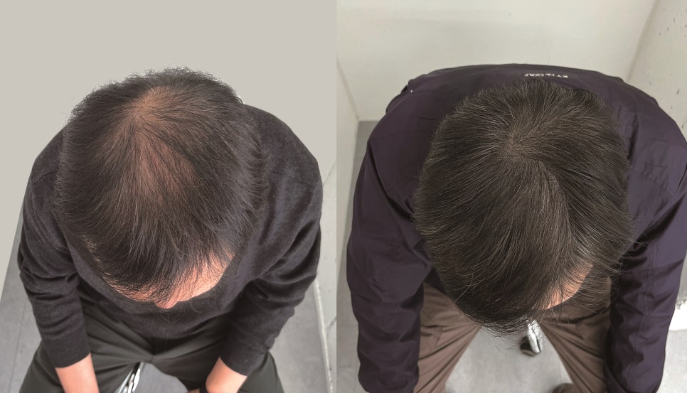 스칼프디자인센터 이미지