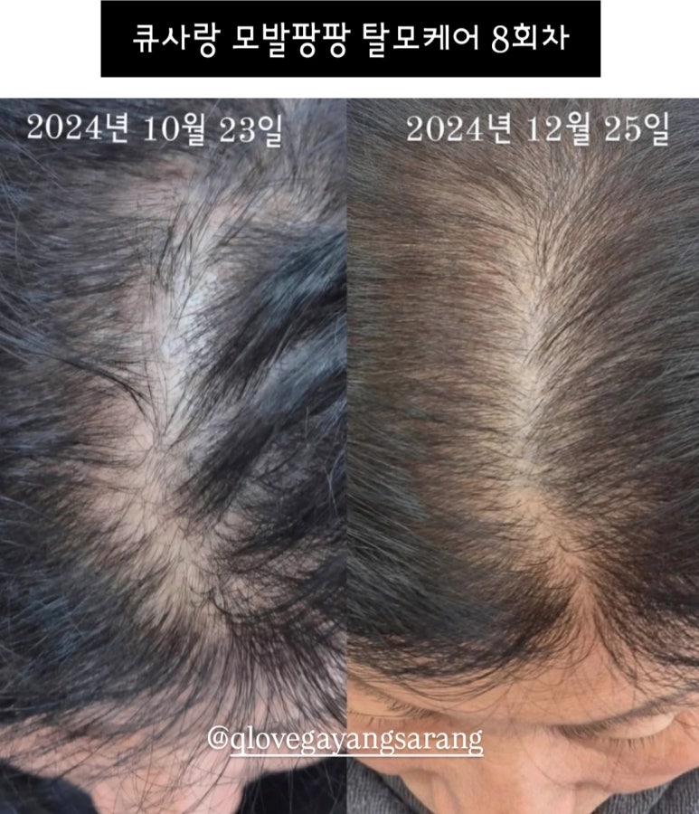 큐사랑대전 이미지