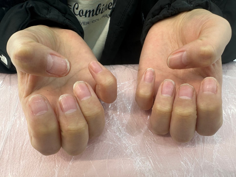 네일블라썸(Nail blossom) 이미지