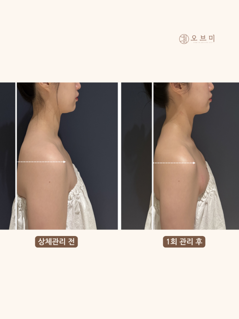 미 에스테틱 이미지