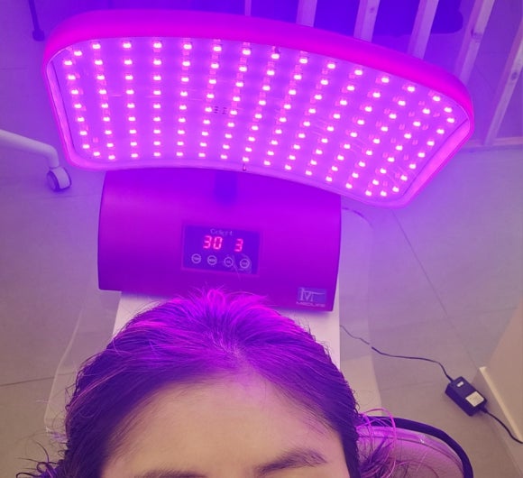 동탄탈모두피본연 이미지