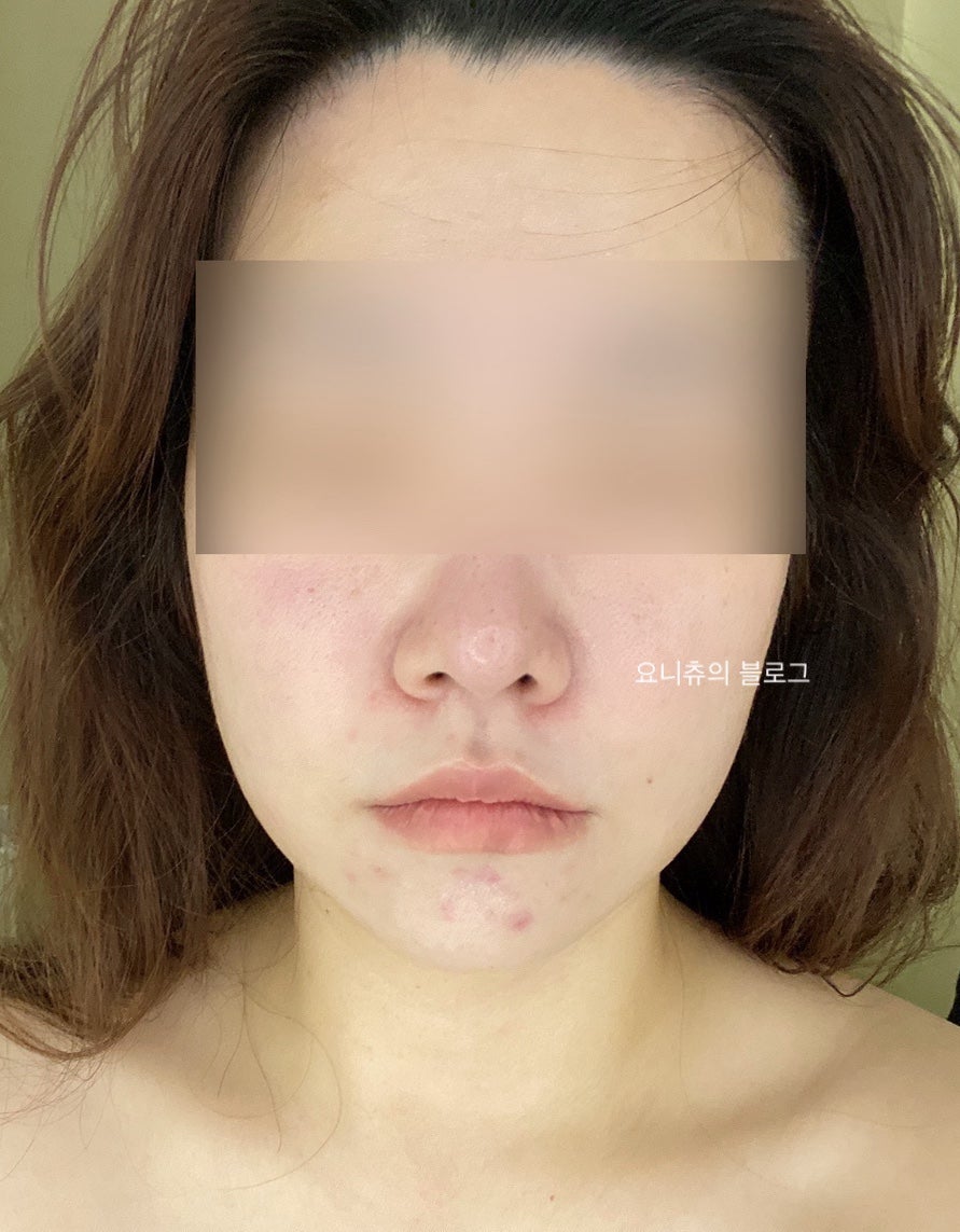 어라운더 스킨 이미지