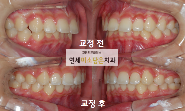 연세미소담은치과 이미지