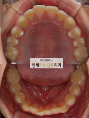 연세미소담은치과 이미지