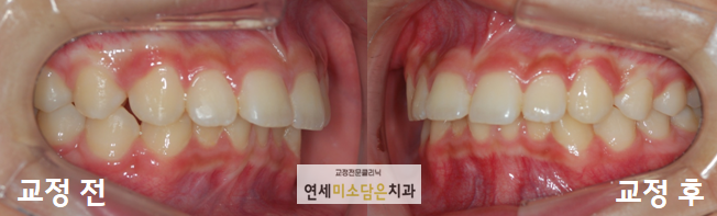 연세미소담은치과 이미지