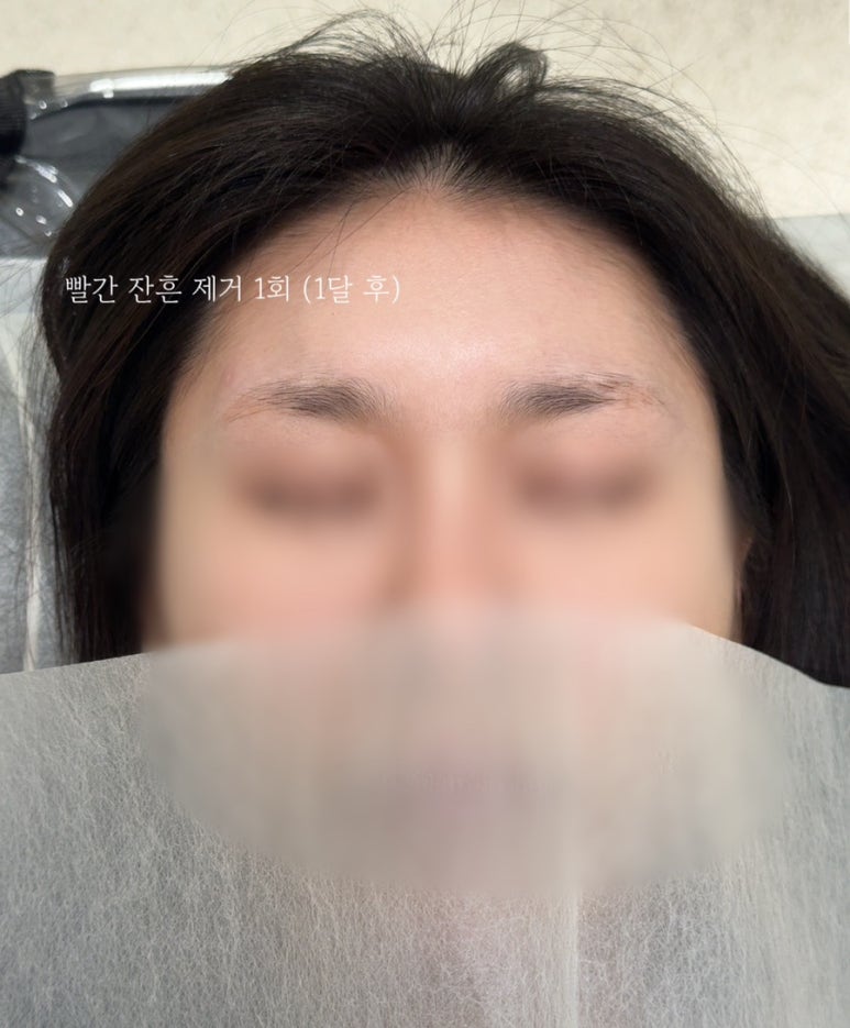 어랏뷰티 이미지