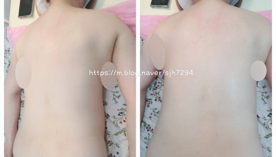 라즈베리뷰티 이미지