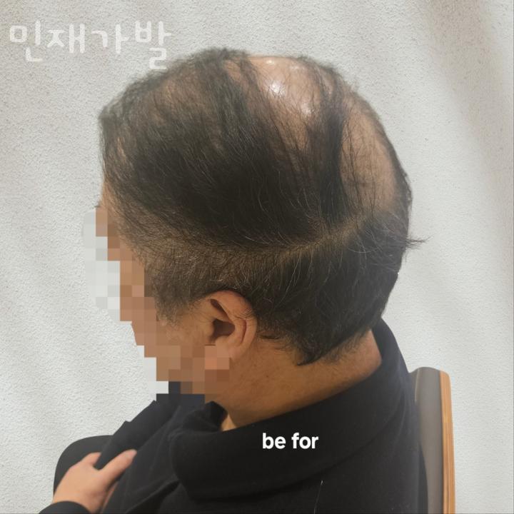 민재가발 이미지