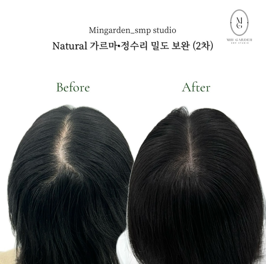 헤어팡팡&가발 이미지