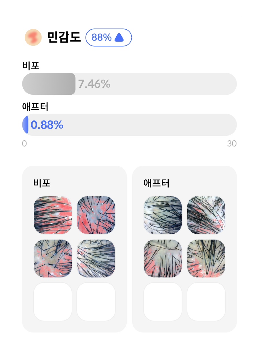 헤드스파루시 이미지
