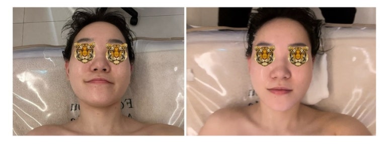 포아유에스테틱 이미지