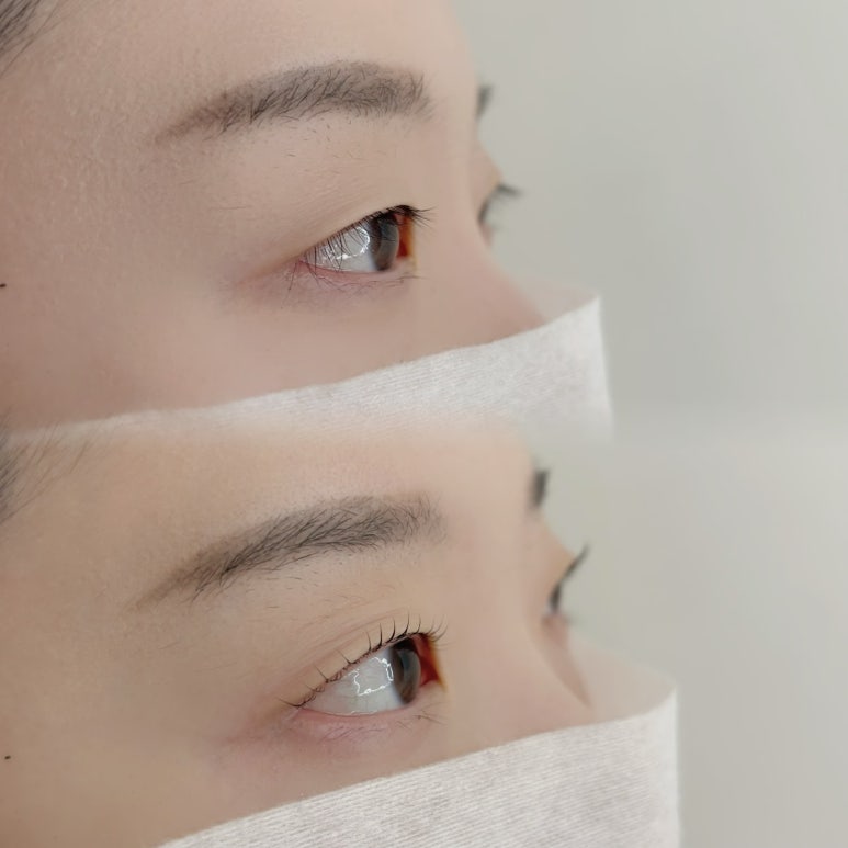 와이오엔 이미지