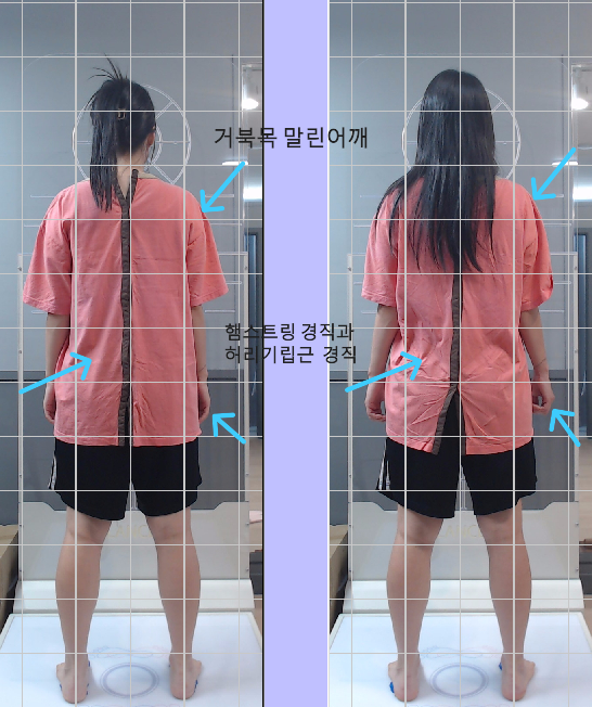 바른몸체형교정운동센터 이미지