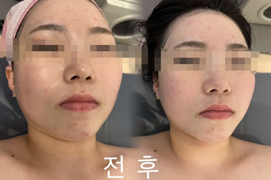제이영뷰티 이미지