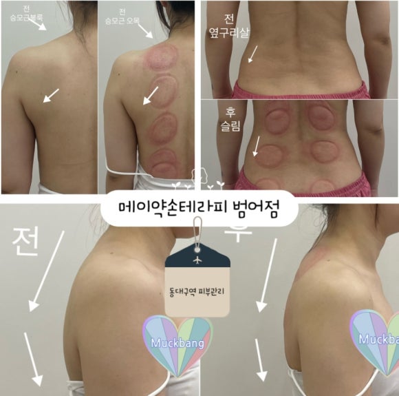메이약손테라피 이미지