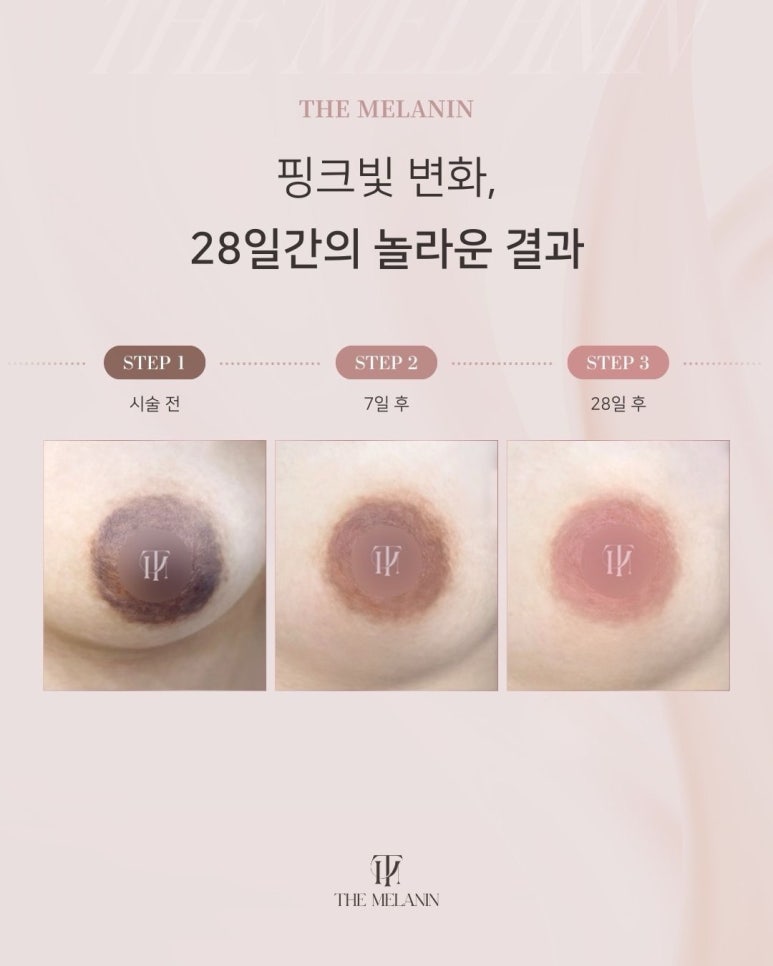 누니래쉬 이미지