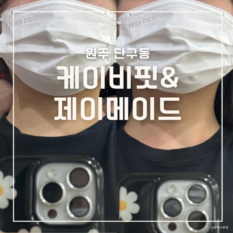 제이케이비 이미지