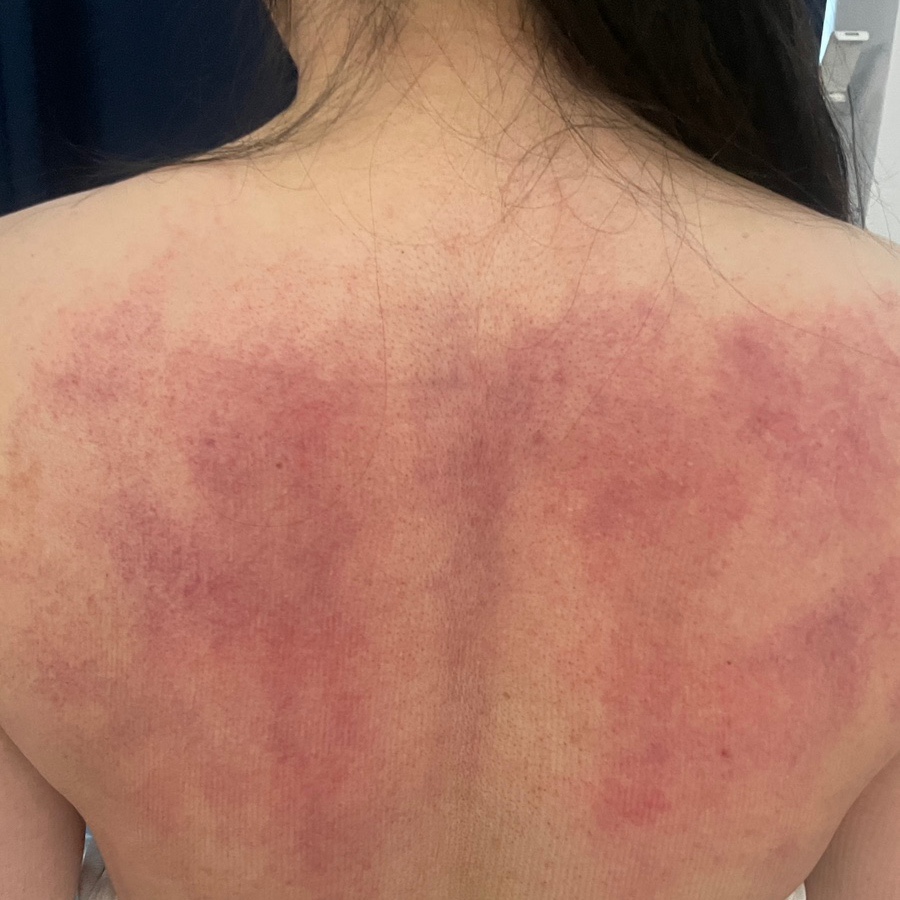 라라메디스킨앤바디 이미지