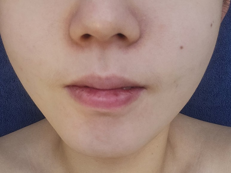 가꾸미에스테틱 이미지
