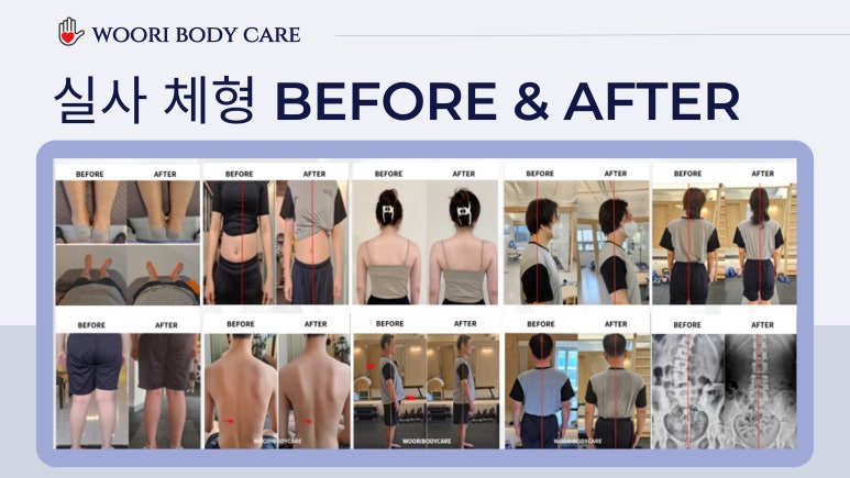바디케어체형관리 이미지