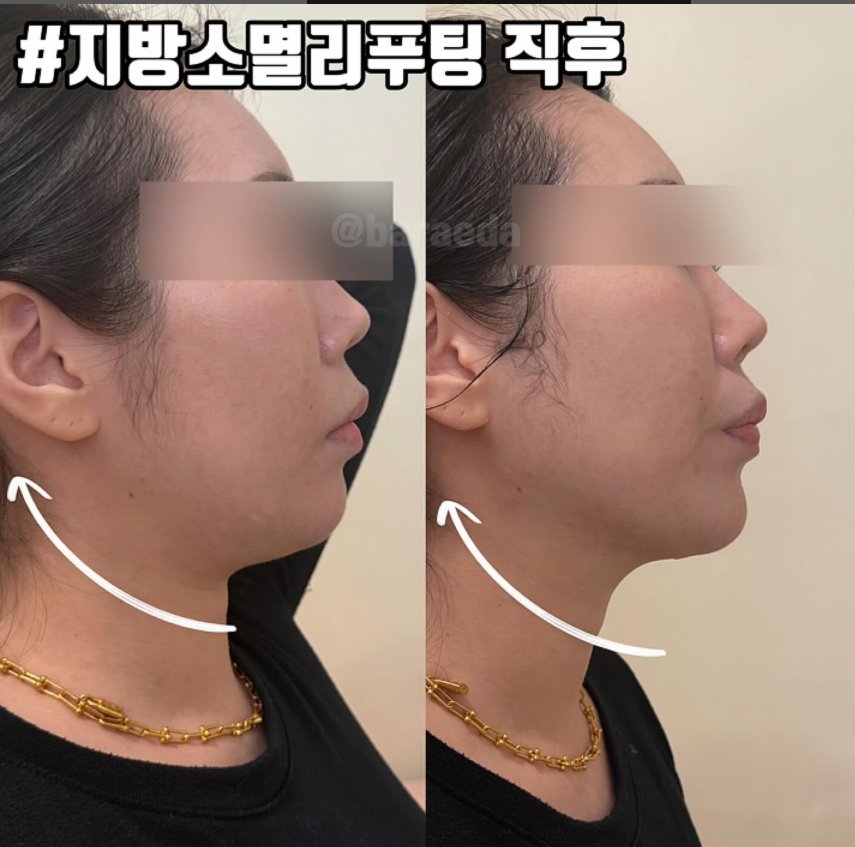 눈바래다 이미지