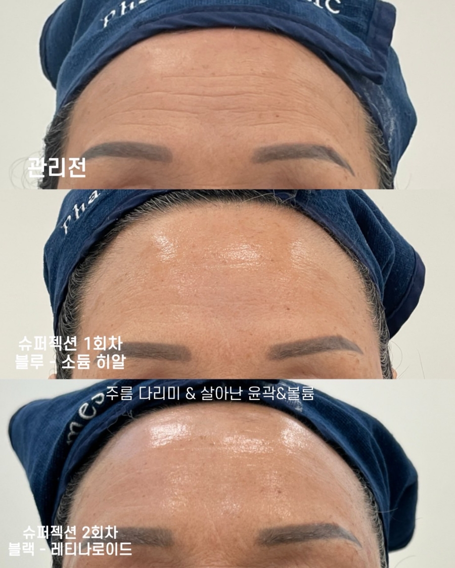 쁘에르 이미지