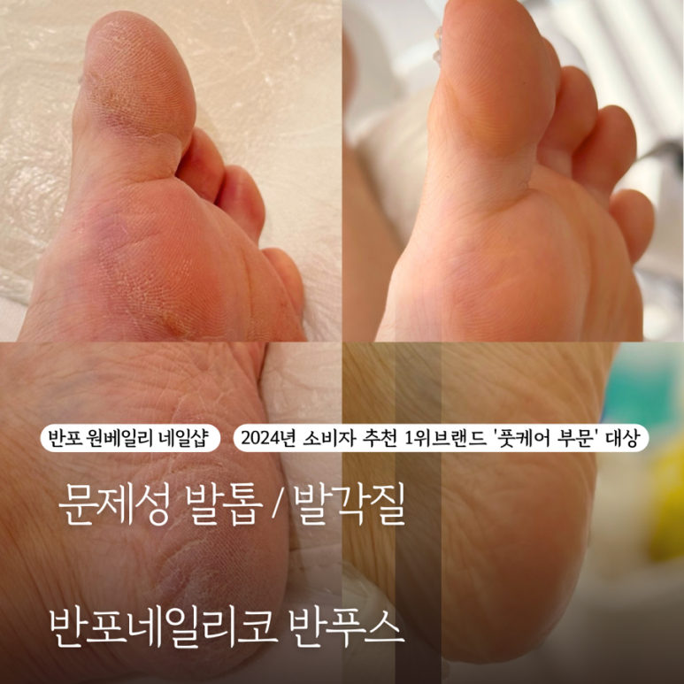 네일리코레푸스 이미지