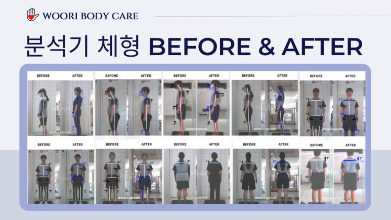 바디케어체형관리 이미지