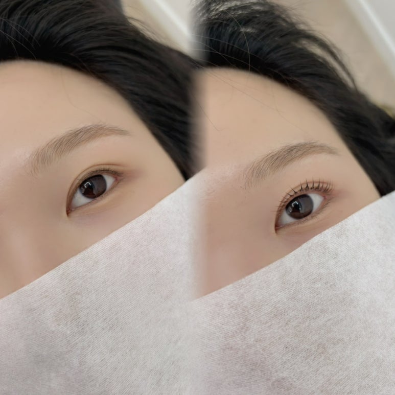 와이오엔 이미지