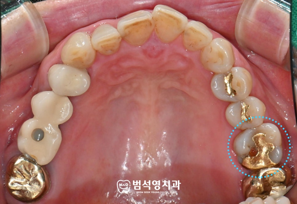 범석영치과 이미지