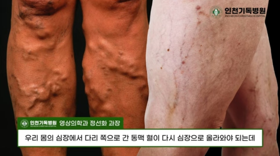인천기독병원 이미지