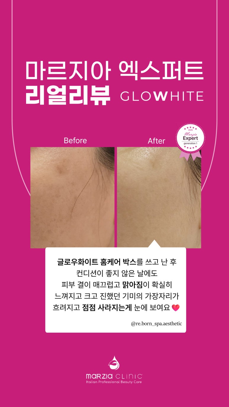 글로우에스테틱 이미지