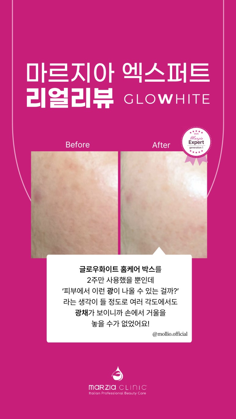 글로우에스테틱 이미지