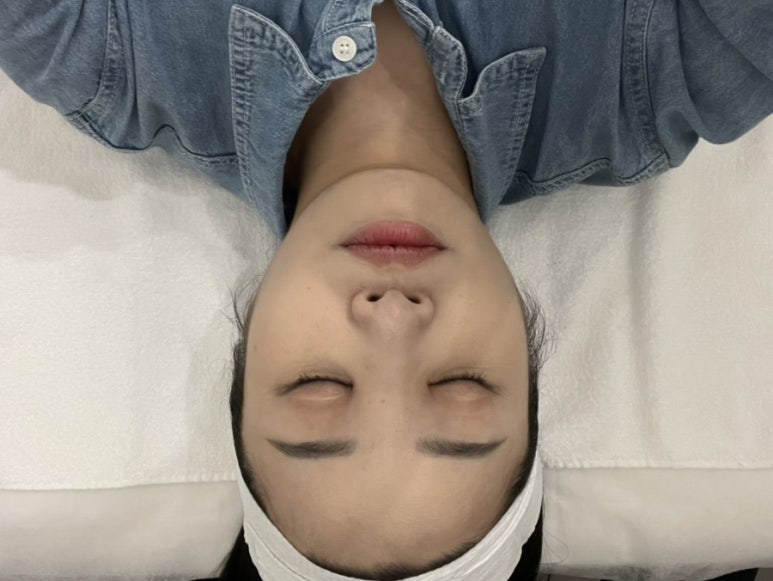 아누보스킨 이미지