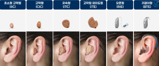 메디컬 보청기 이미지