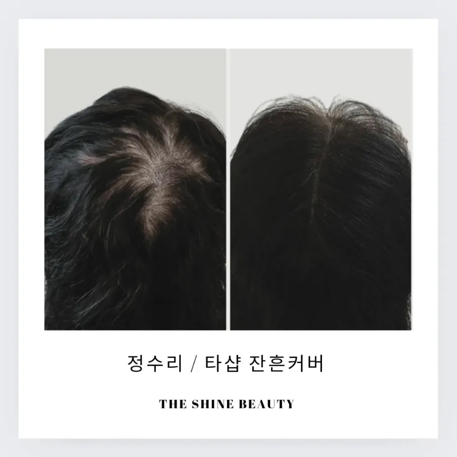 더샤인뷰티 이미지