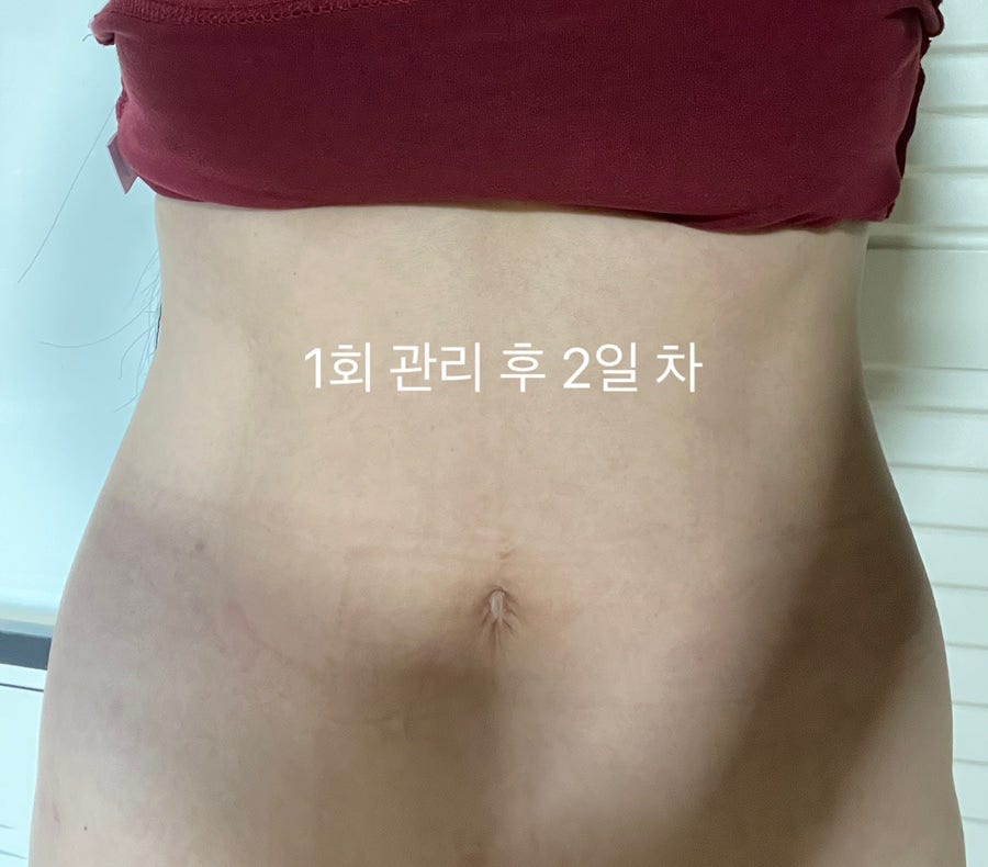 키아라천안 이미지