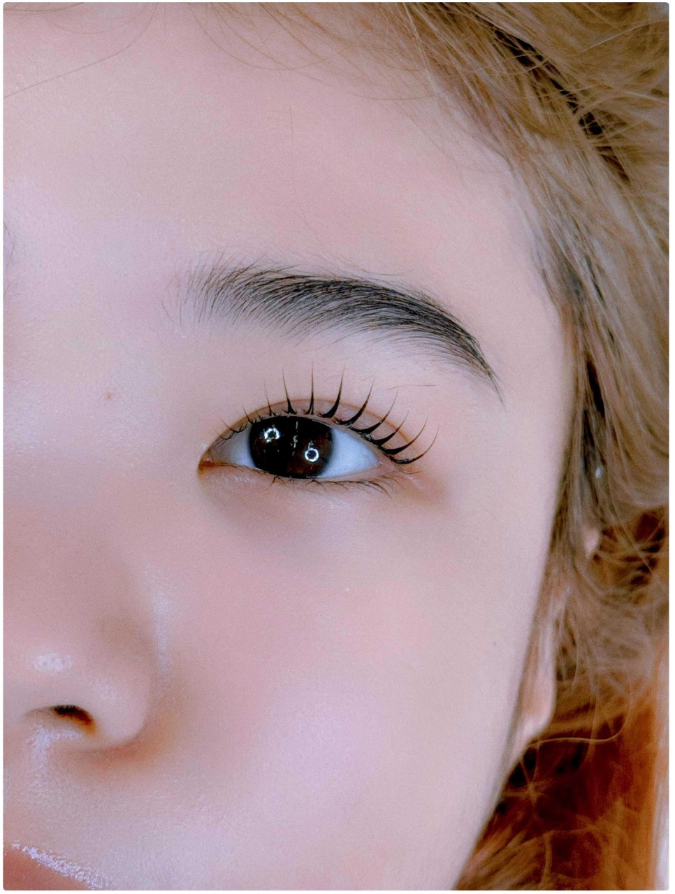 래시베이 이미지