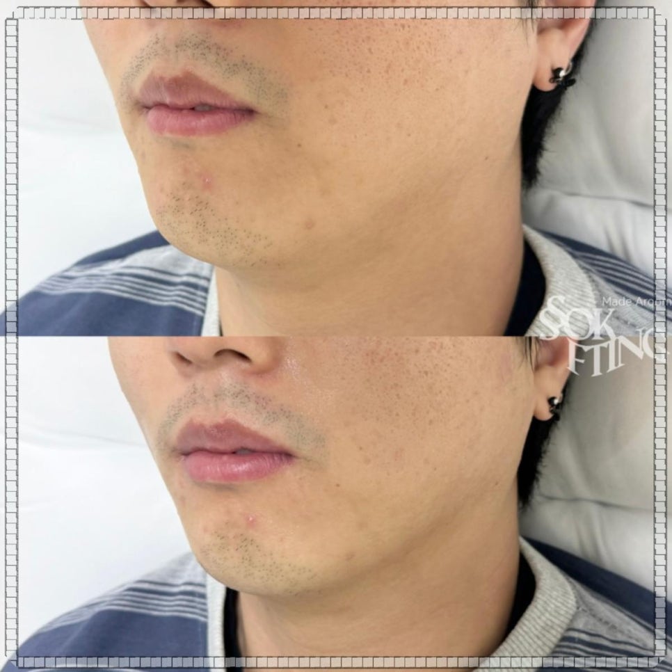 아룸뷰티 이미지