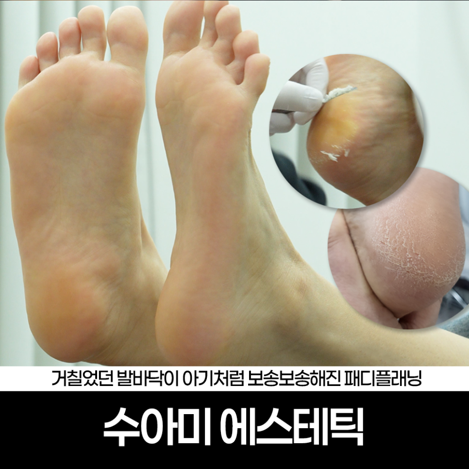 수아미에스테틱 이미지