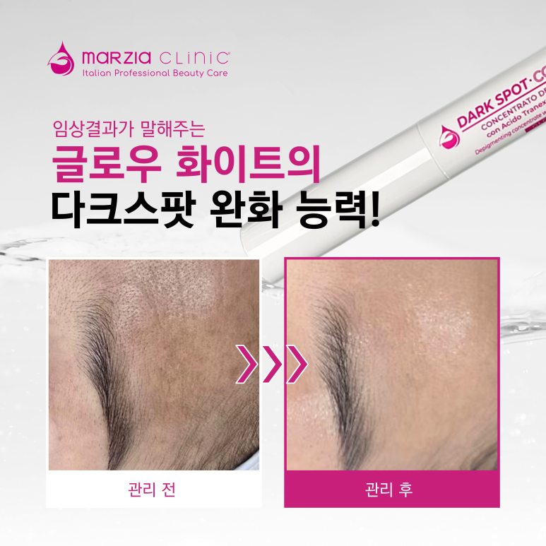 글로우에스테틱 이미지